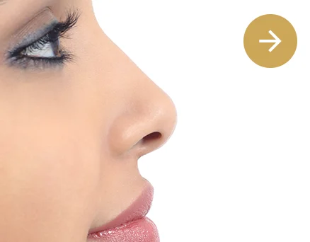 Clínica Otosalud. Cirugía estética facial. rinomodelación