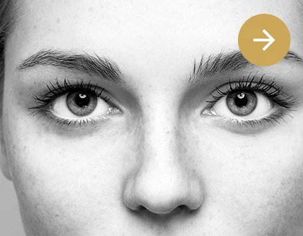 Clínica Otosalud. Cirugía estética facial. rinoplastia