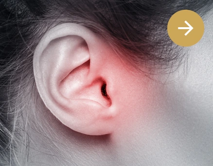 Clínica Otosalud. Nariz. Taponamientos