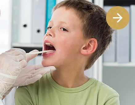 Clínica Otosalud. Garganta. Amigdalitis