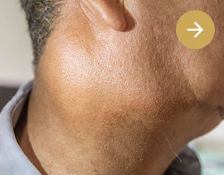 Clínica Otosalud. Garganta. Gándulas salivares