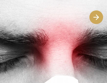 clínica otosalud. otorrinolaringologia. nariz