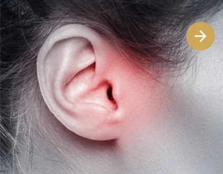 clínica otosalud. otorrinolaringologia. oido