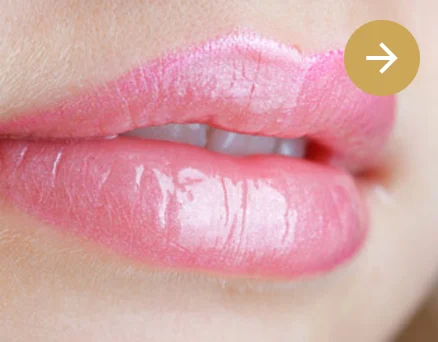 Clínica Otosalud. Medicina Estética Facial. eliminación código barras​​