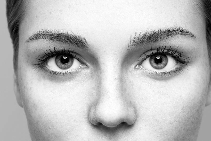 Recomendaciones a seguir antes, durante y después de la rinoplastia